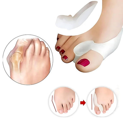 BunionGuard Hallux Valgus | Protection en silicone avec écarteur d’orteils – Soulagement de la douleur et alignement correctif